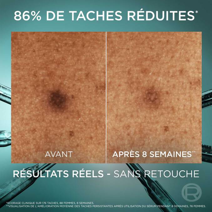 Bright Reveal Sérum Anti-Taches Niacinamide