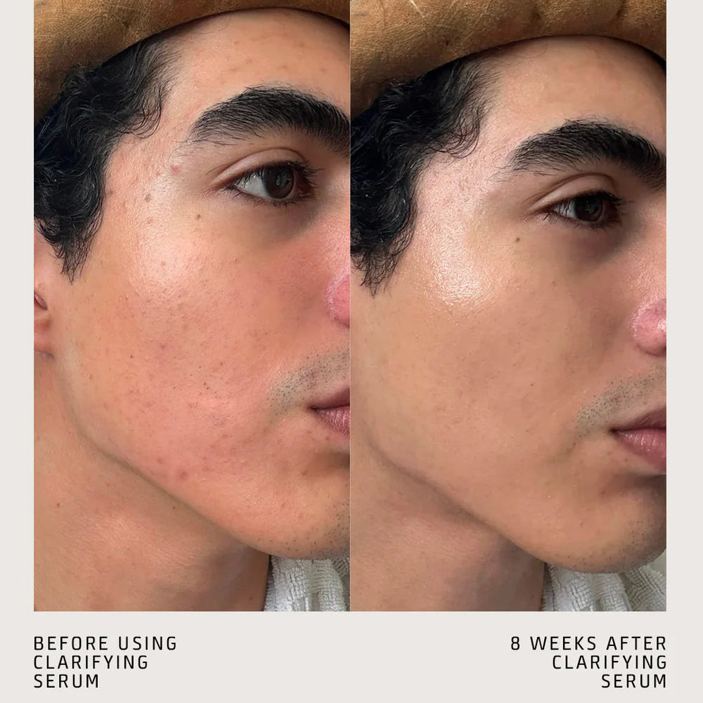 CLARIFYING SERUM