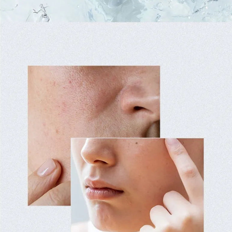 Anua - Birch Moisture Boosting Serum - Sérum