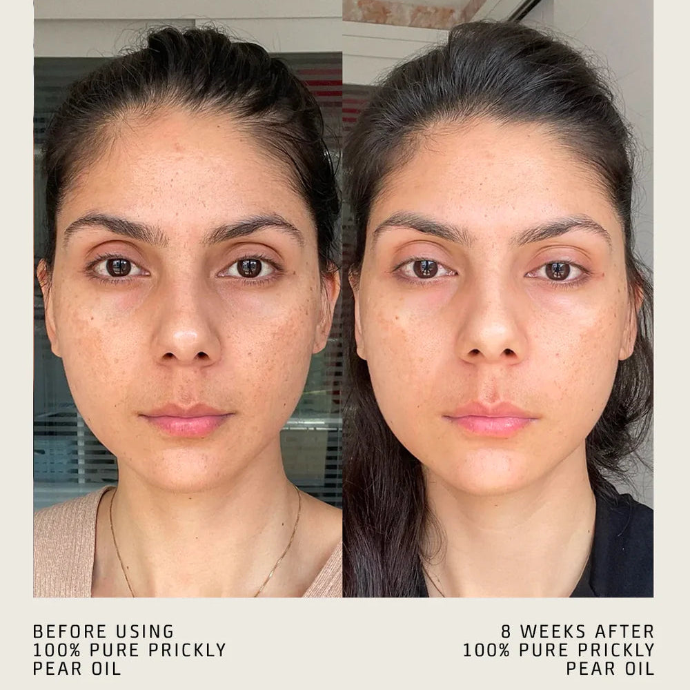 100% PURE PRICKLY PEAR OIL