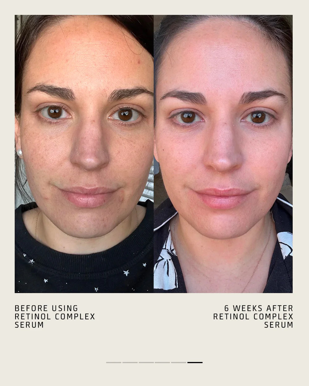 RETINOL COMPLEX SERUM