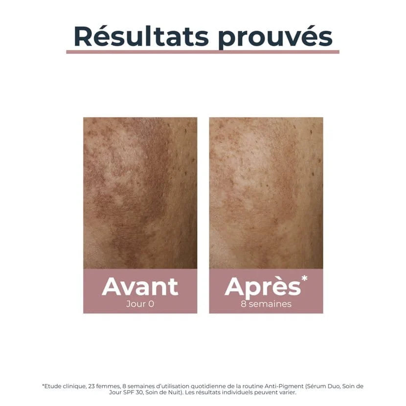 ANTI-PIGMENT Sérum Duo