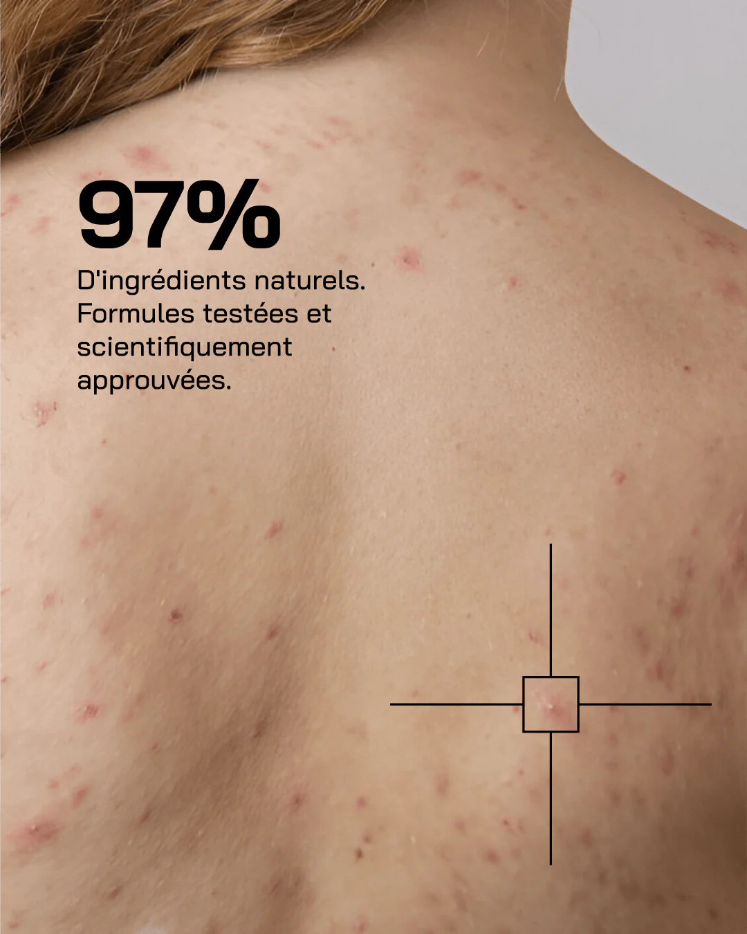 Touché Gel Douche nettoyant Anti-Imperfections