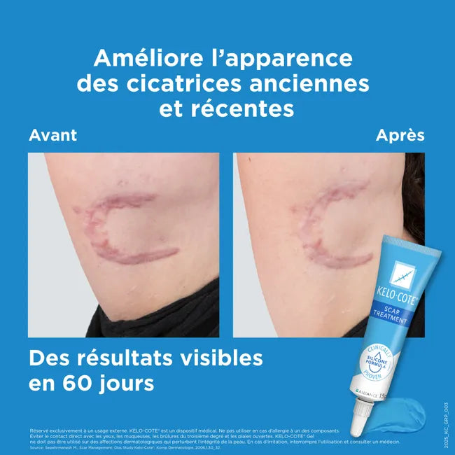 Kelo Cote Gel Pour Cicatrices –15g