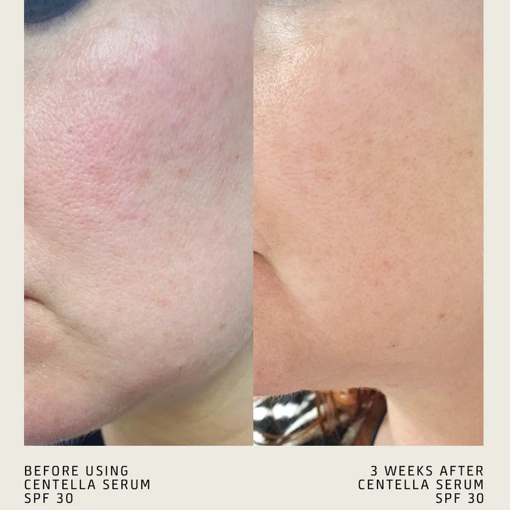 CENTELLA SERUM SPF 30