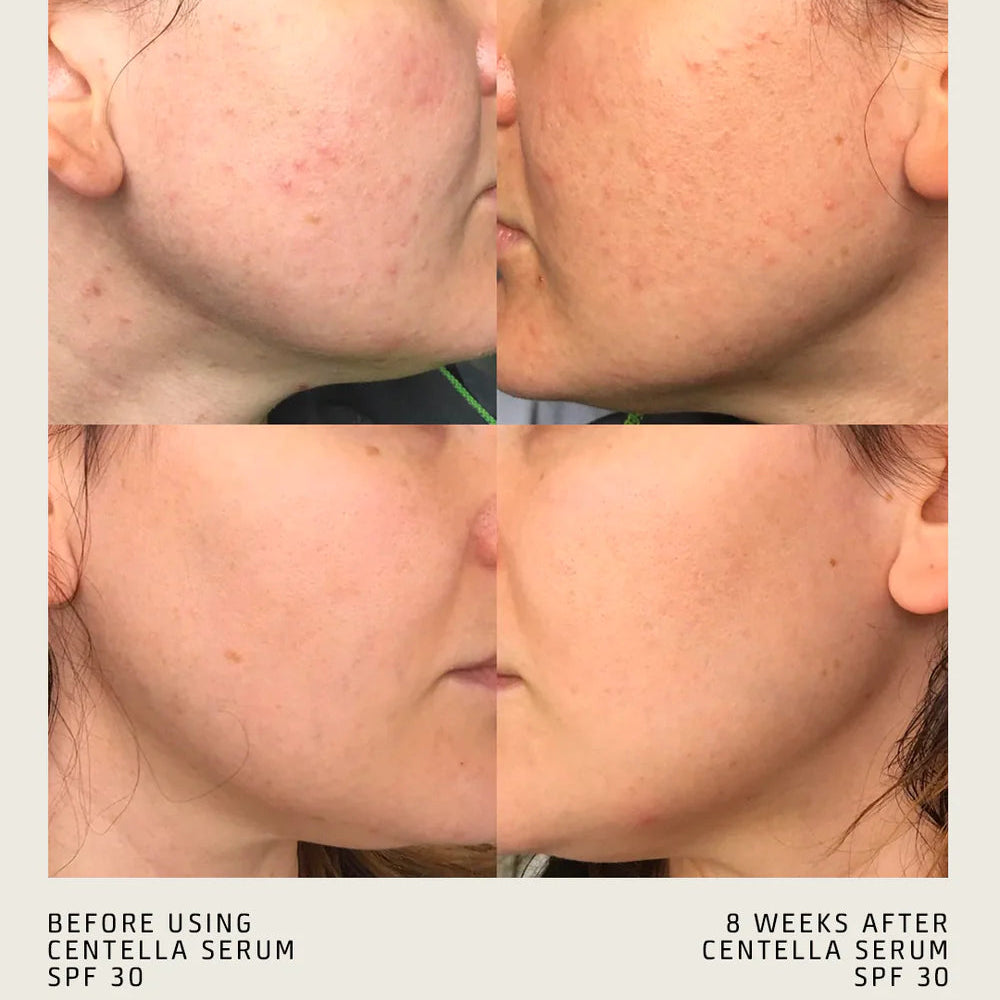 CENTELLA SERUM SPF 30