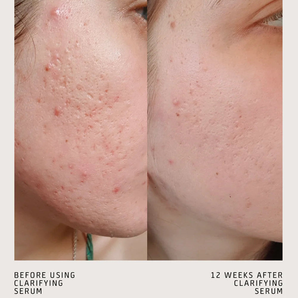CLARIFYING SERUM