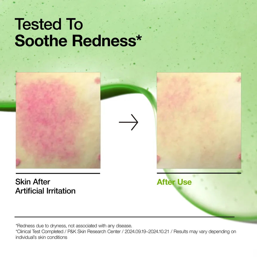 Anua - Azelaic Acid 10 Hyaluron Redness Soothing Serum - Sérum apaisant anti-rougeurs