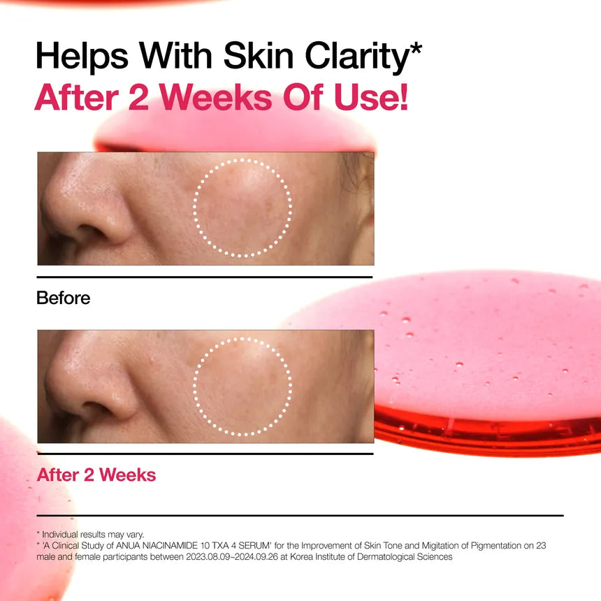 Anua - Niacinamide 10%