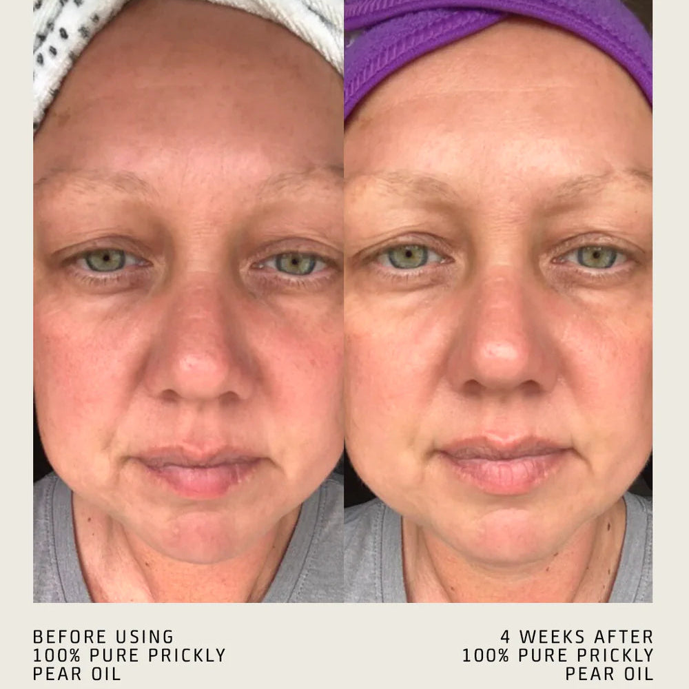 100% PURE PRICKLY PEAR OIL