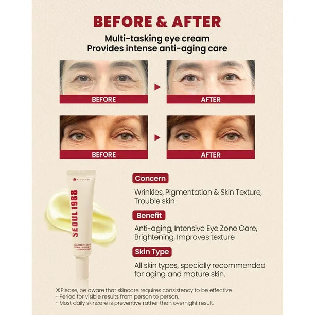 SEOUL 1988 Eye Cream : Retinal Liposome 4% + Fermented Bean