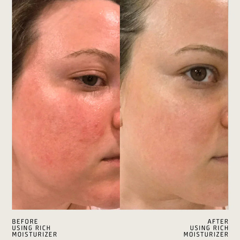 RICH MOISTURIZER