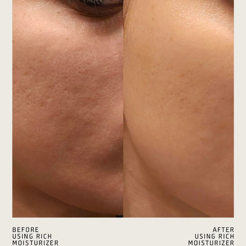 RICH MOISTURIZER