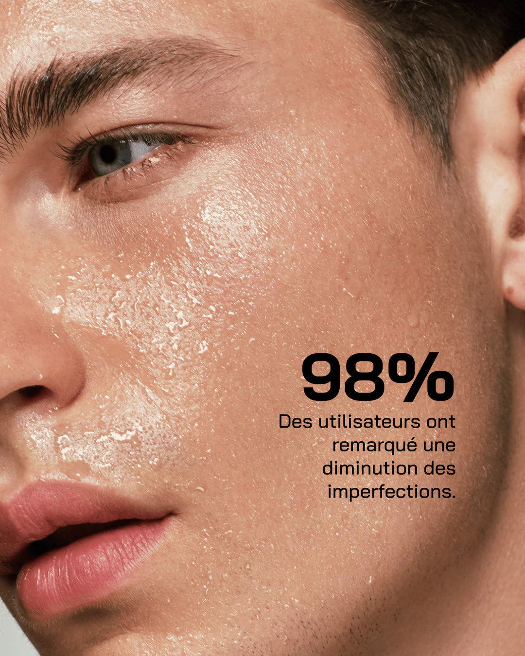 Touché Acide Salicylique