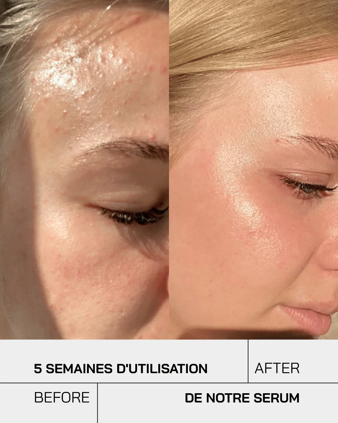 Touché Sérum Niacinamide 10% + Zinc 1%