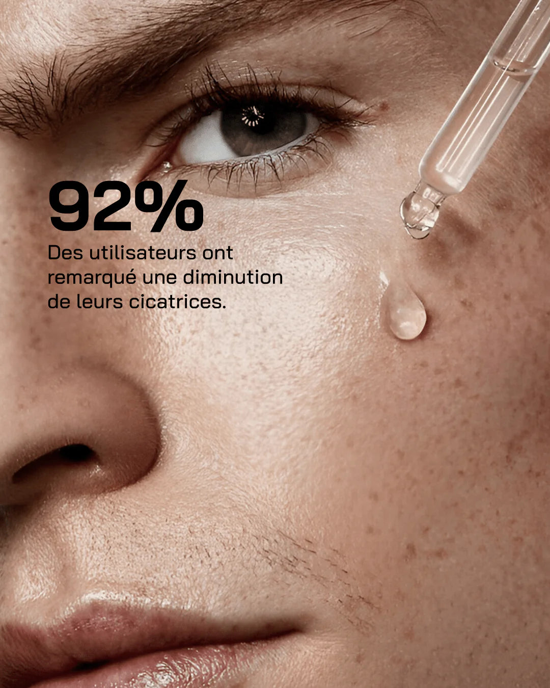 Touché Sérum Niacinamide 10% + Zinc 1%