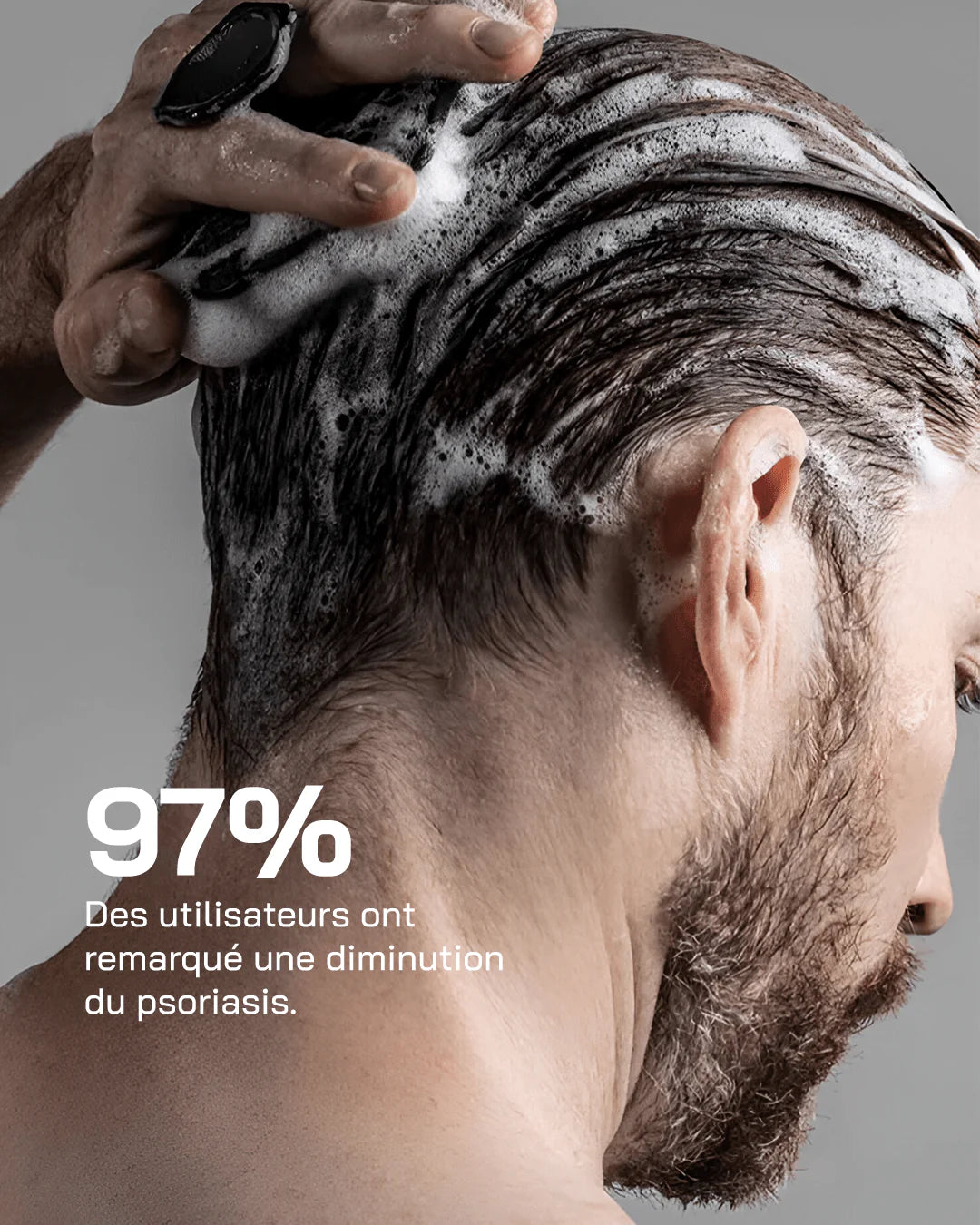 Touché Routine Psoriasis Control