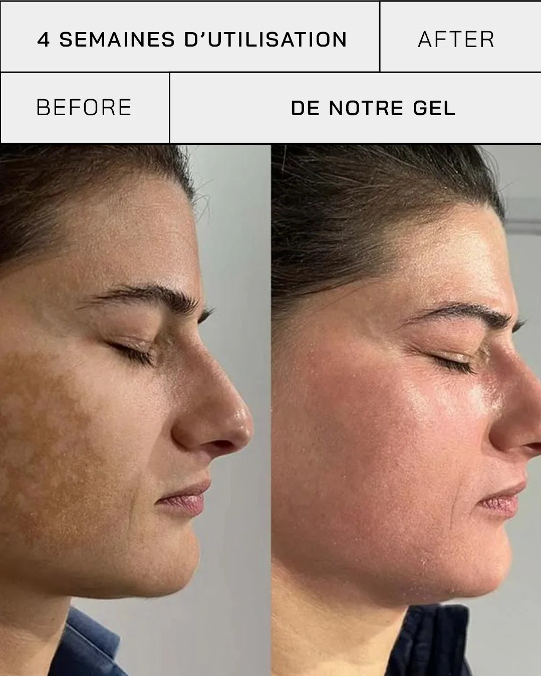 Gel Vitamine C 11% + SPF 30